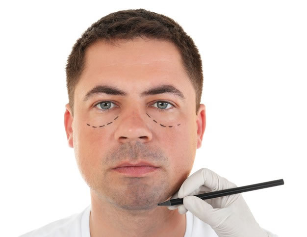 blefaroplastia em curitiba cirurgia das pálpebras