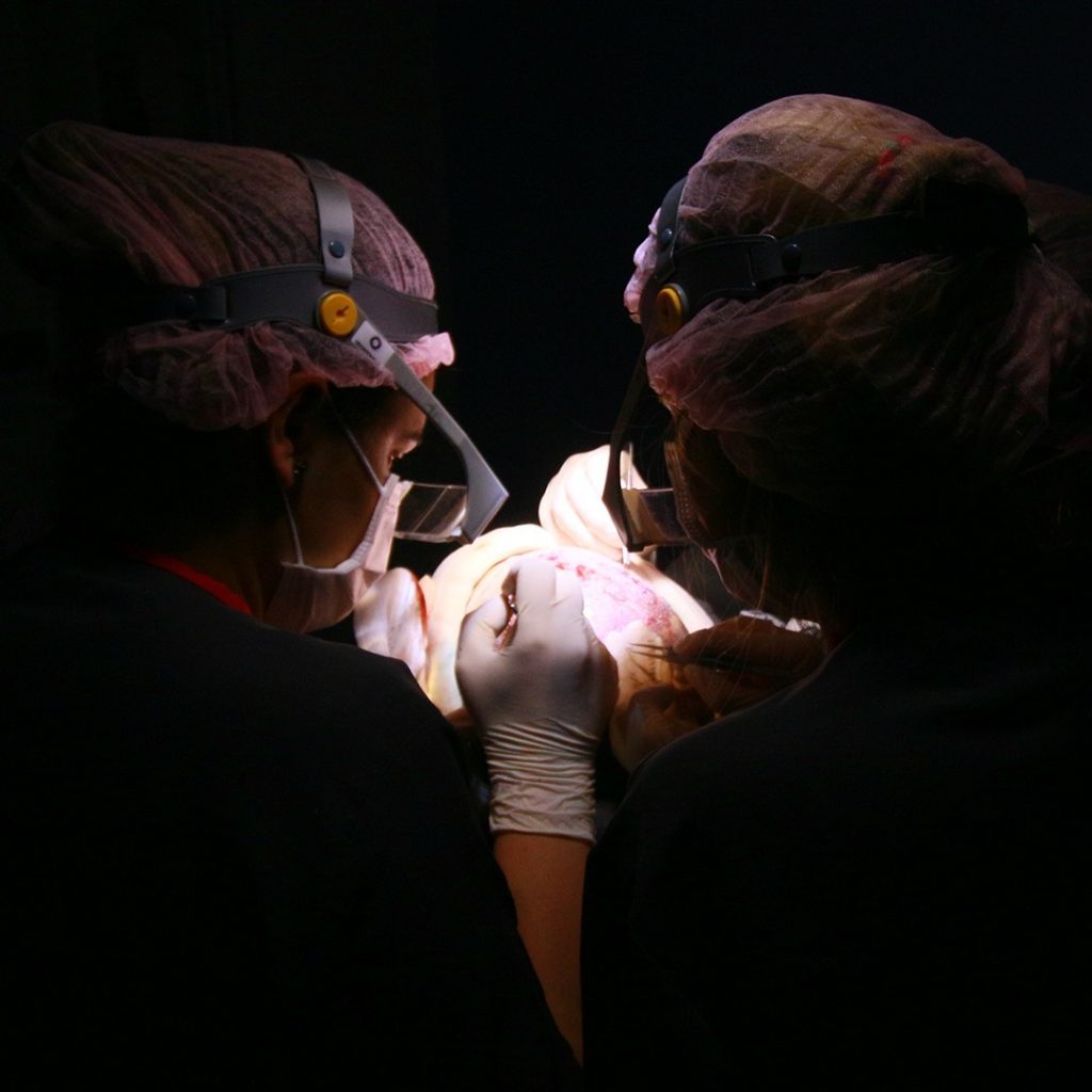 transplante capilar em curitiba com resultados naturais