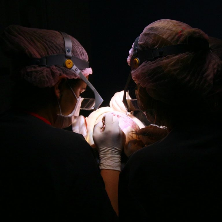 transplante capilar em curitiba com resultados naturais