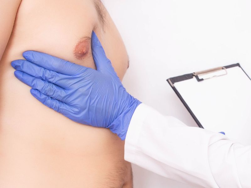 Médico Especialista em Cirurgia de Ginecomastia em Curitiba